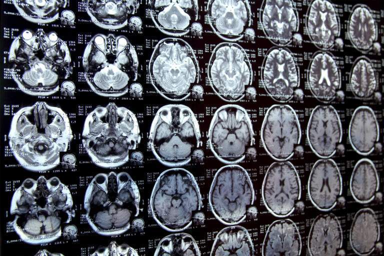 New AI system could accelerate clinical research