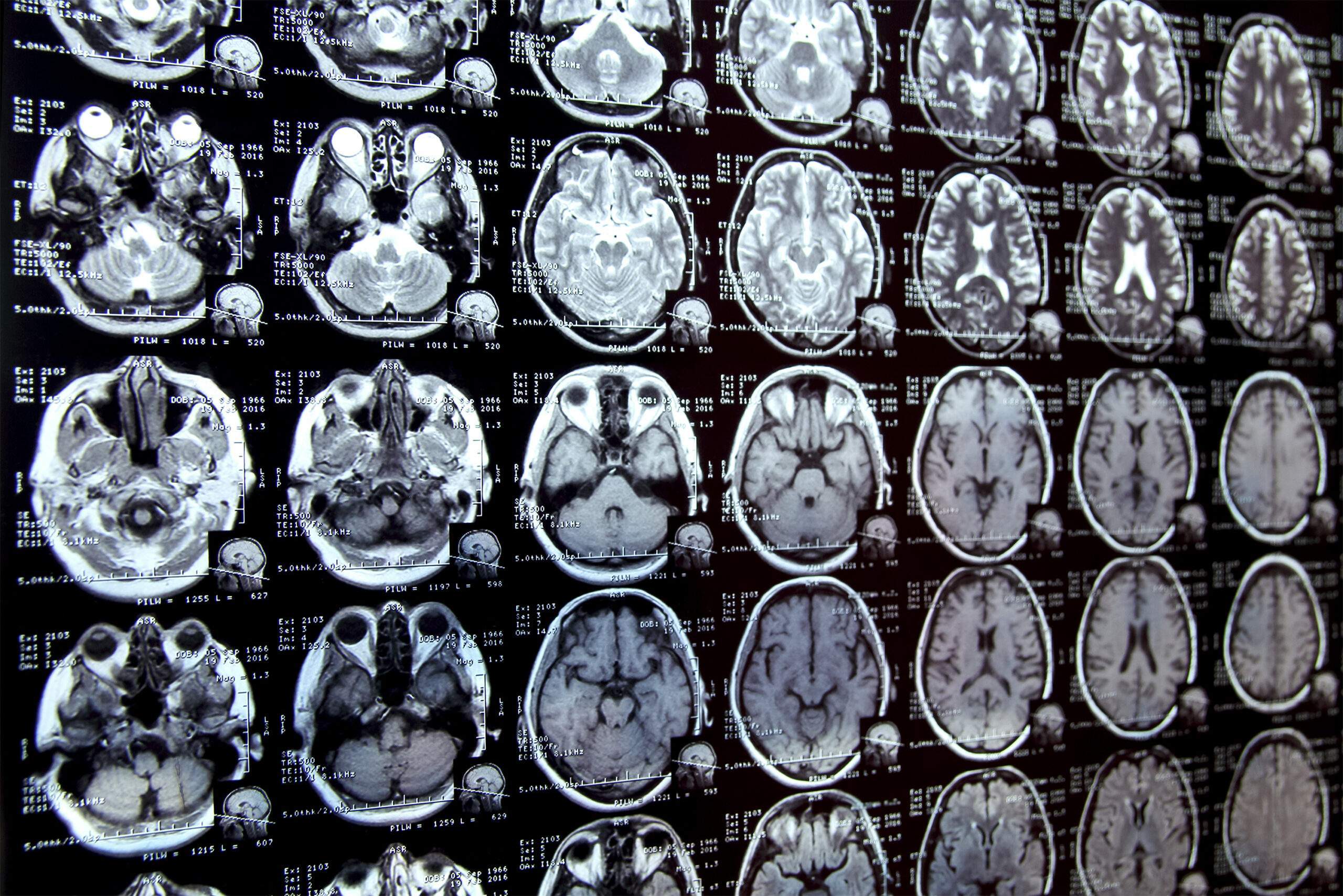 New AI system could accelerate clinical research New AI system could accelerate clinical research