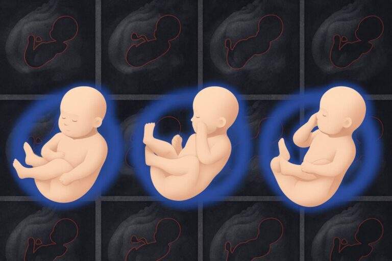 Machine-learning tool gives doctors a more detailed 3D picture of fetal health