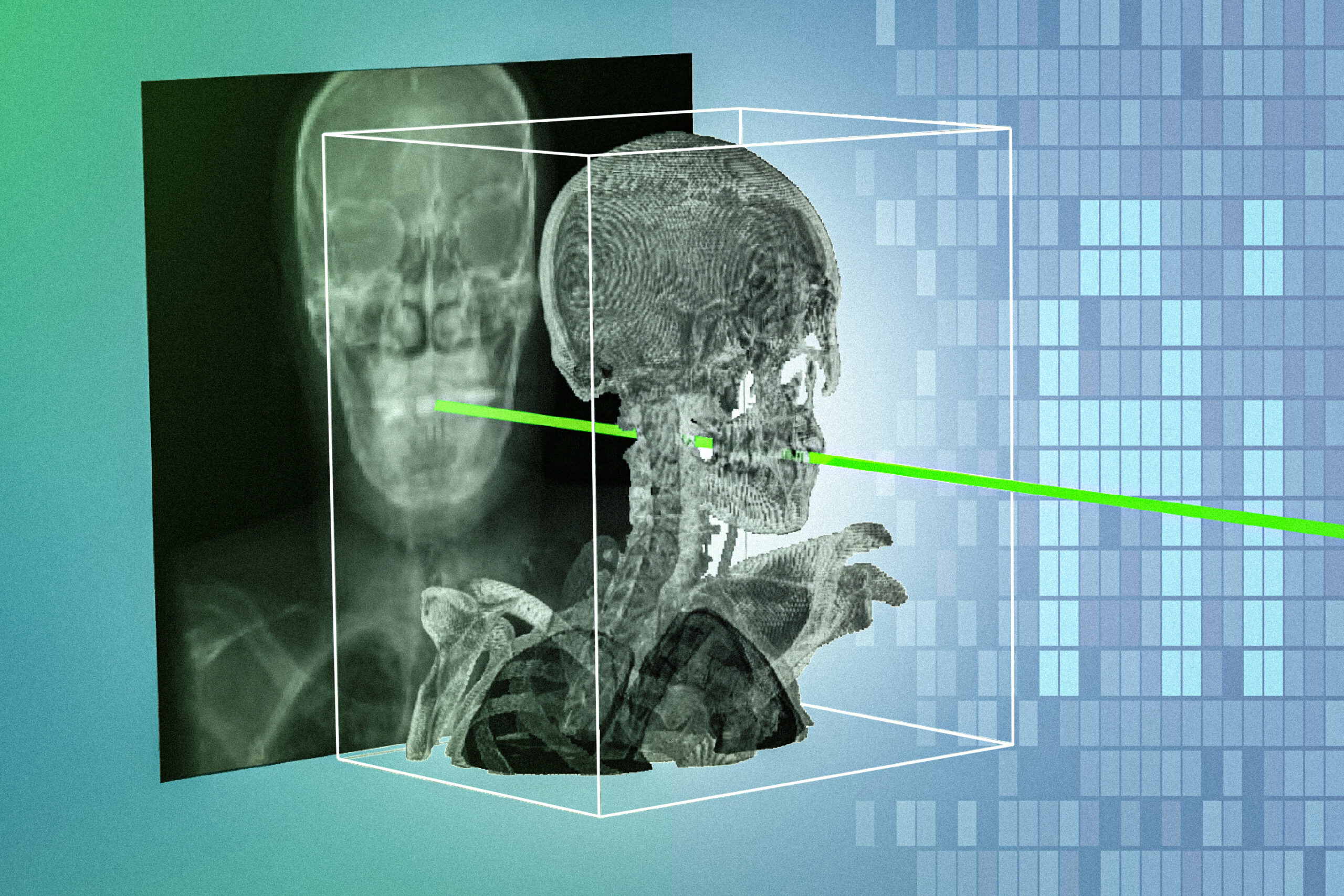 New AI technique could make minimally invasive surgeries safer and more precise New AI technique could make minimally invasive surgeries safer and more precise