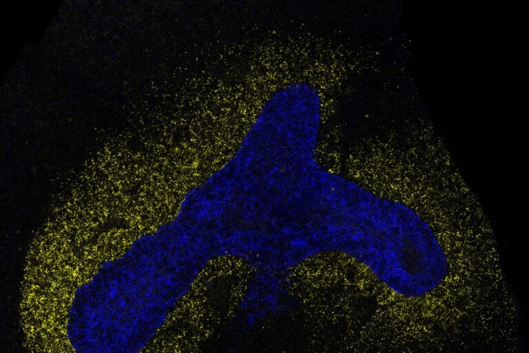 AI model decodes the language cells use to communicate AI model decodes the language cells use to communicate